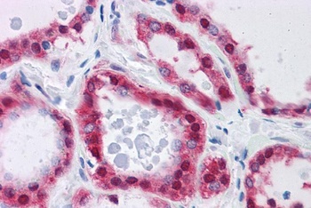 GPI / Neuroleukin Antibody