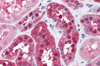 GPI / Neuroleukin Antibody