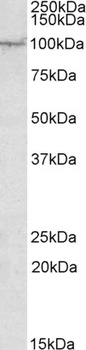 HMGI-C/HMGA2 Antibody