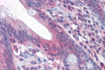 RAP80 Antibody
