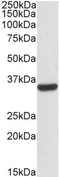 CA1 Antibody