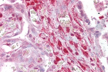 CA1 Antibody