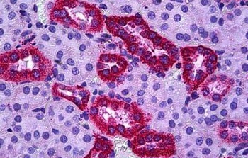 SH2D3A / NSP1 Antibody