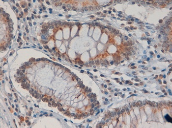 PIM2 Antibody
