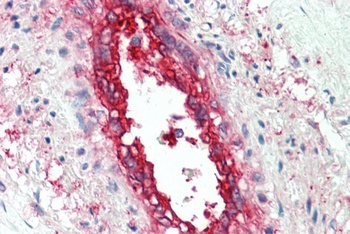 EHD2 Antibody