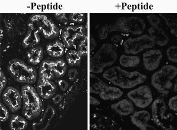 MMP3 Antibody