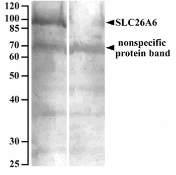 MMP3 Antibody