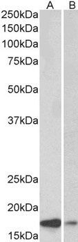 SH3GL2 Antibody