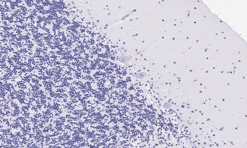 NDUFA7 Antibody