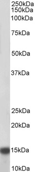 HIC2 Antibody