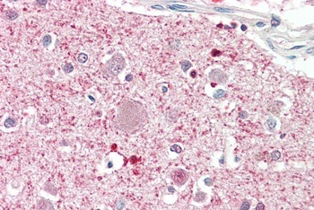 Fubp1 Antibody