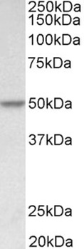 Fubp1 Antibody