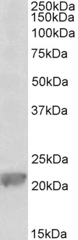 LSM2 Antibody