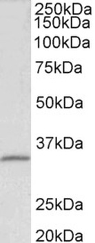 GEM Antibody
