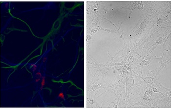 AARS2 Antibody
