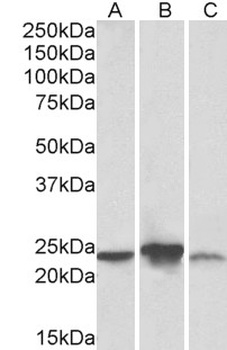 C12orf29 Antibody