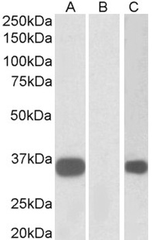 MAT2B Antibody