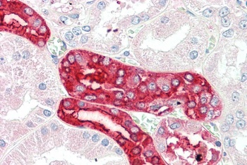 AIMP1 Antibody