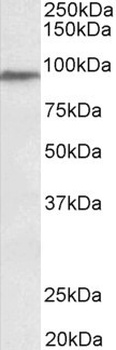 USP6 Antibody