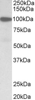 USP6 Antibody