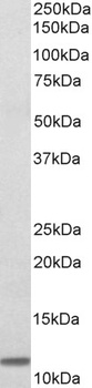 SDCCAG8 Antibody