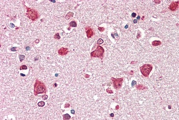 LVA Antibody