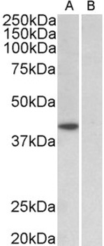 Hdac1 Antibody