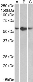 SFTPA1 Antibody