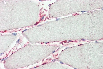 ARPC1A Antibody