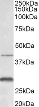 ARPC1A Antibody