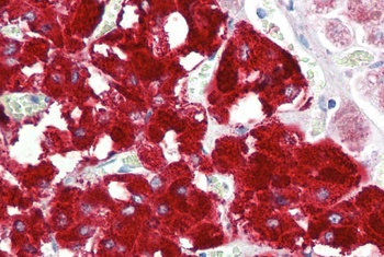 HDAC1 Antibody