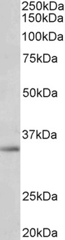 IRF4 Antibody