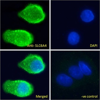 SRD5A1 Antibody