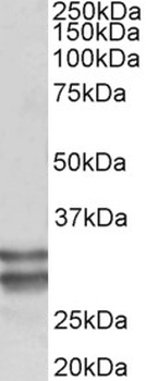 SLC6A4 Antibody