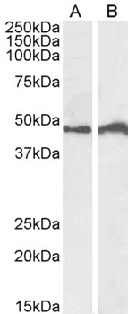 AKT2 Antibody