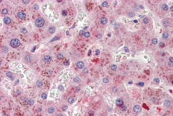 SLC6A8 Antibody