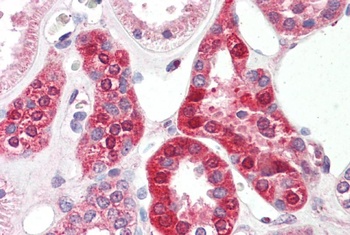 CTDSP1 Antibody