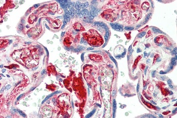 CADM1 Antibody