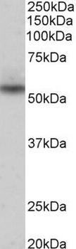 SLC47A2 Antibody