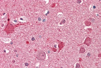 TIMP1 Antibody