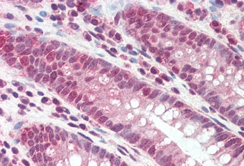 ATP2B1 Antibody