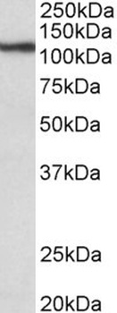 NPPA Antibody