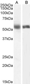 CYP2C8 Antibody
