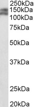 CRLS1 Antibody