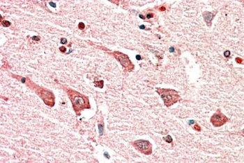 TPO Antibody