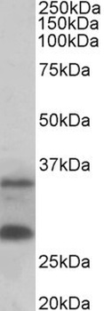 STK38 Antibody