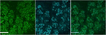 TSHR Antibody