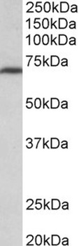 TPO Antibody