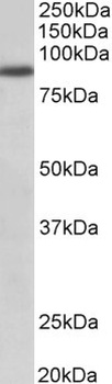TPO Antibody