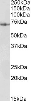 KDM2A Antibody